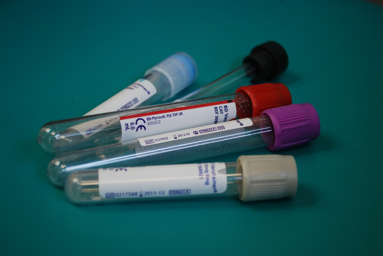 Podstawowe badania krwi w profesjonalnym laboratorium