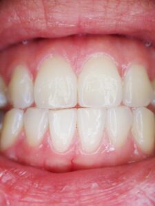 Dlaczego bolą zęby? Przyczyny i sposoby radzenia sobie z bólem